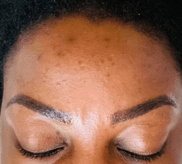 Permanent Makeup Procedures